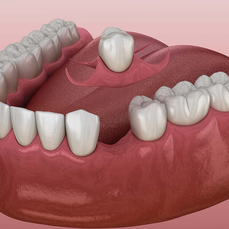 Treatment - March Dental