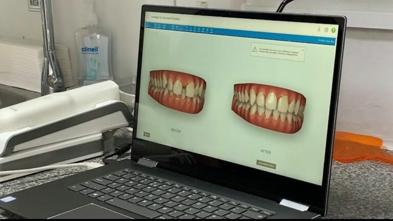 Reporter Ben Jolley is undergoing Invisalign treatment thanks to March Dental Surgery. Here, Dr Kishan Patel shows him what his teeth should look like after treatment. – Credit: MARCH DENTAL SURGERY