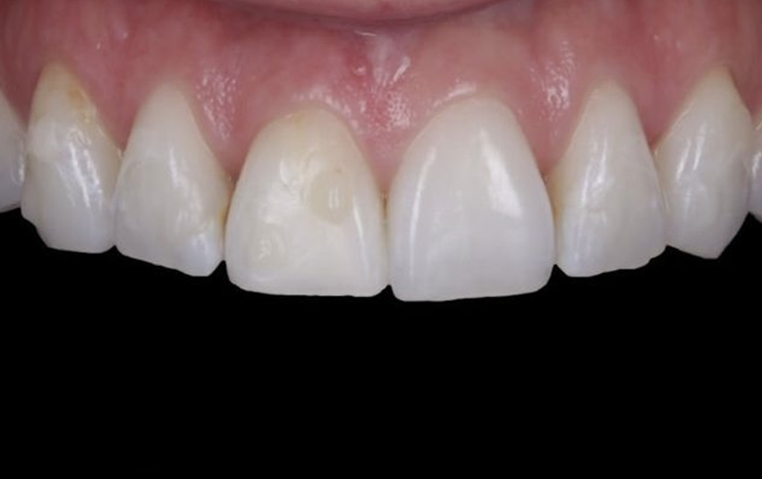 Before - March Dental