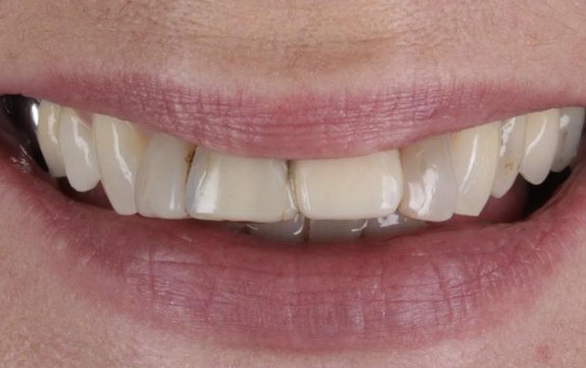 Before - March Dental